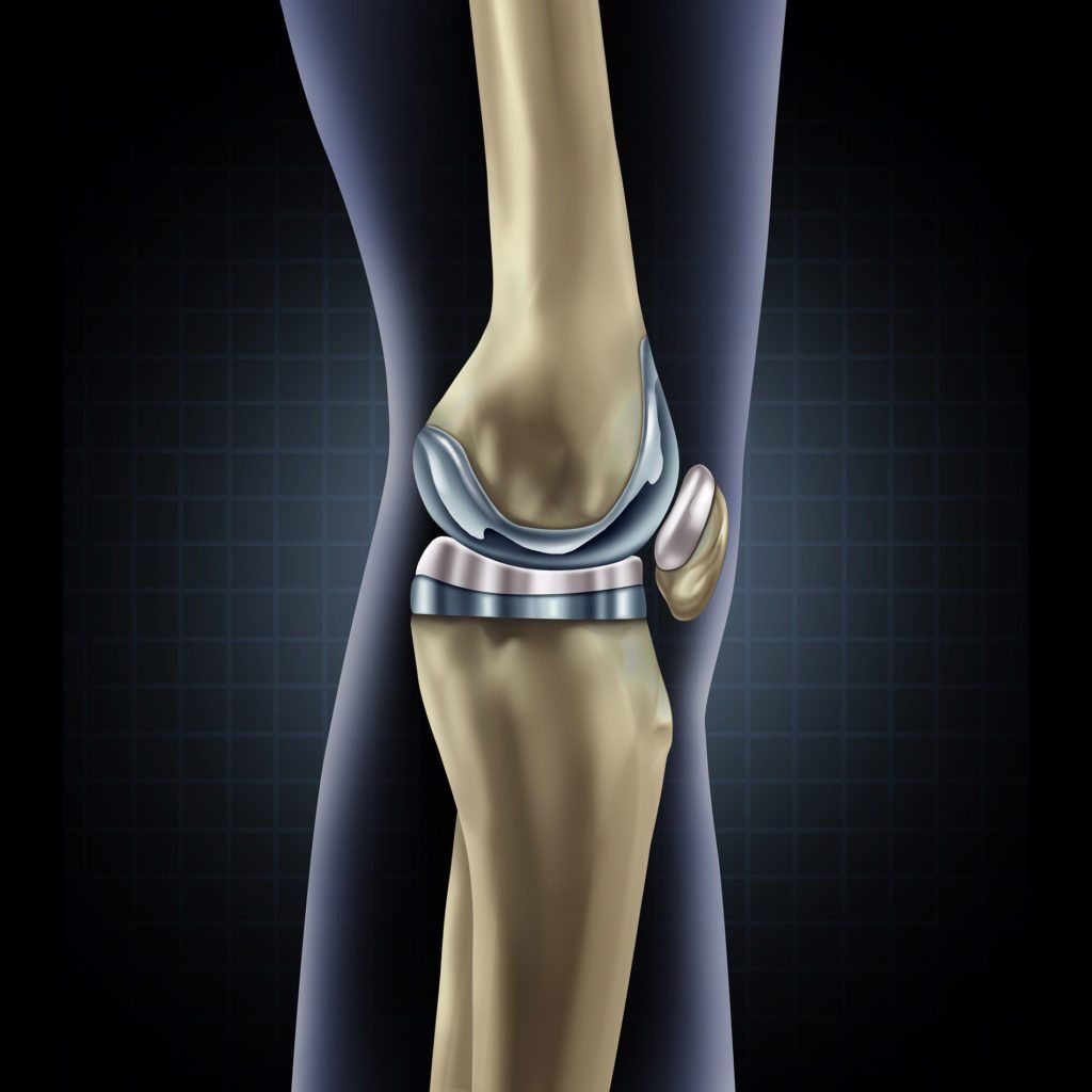 Knee Replacement Space Coast Orthopedicmerritt Orthopedics Merritt